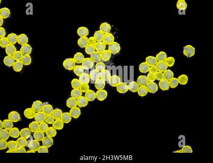 Mikroskopische Ansicht eines Pollen-Körneres der Art „Pollen“ (Pollen). Dunkelfeldbeleuchtung. Stockfoto