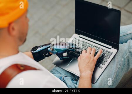 Junger behinderter Mann mit künstlicher prothetischer Hand, der die Tastatur des Laptops benutzte. Stockfoto