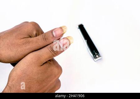 Ein Mensch, der seine großen und schmutzigen Nägel auf weißem Hintergrund zeigt Stockfoto