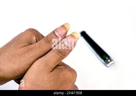 Ein Mensch, der seine großen und schmutzigen Nägel auf weißem Hintergrund zeigt Stockfoto