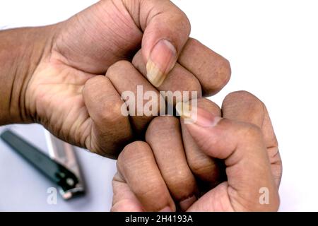 Ein Mensch, der seine großen und schmutzigen Nägel auf weißem Hintergrund zeigt Stockfoto