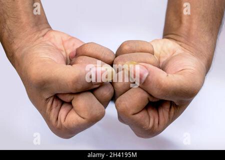 Ein Mensch, der seine großen und schmutzigen Nägel auf weißem Hintergrund zeigt Stockfoto