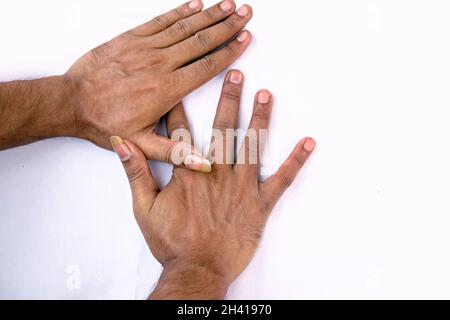 Ein Mensch, der seine großen und schmutzigen Nägel auf weißem Hintergrund zeigt Stockfoto