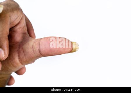 Ein Mensch, der seine großen und schmutzigen Nägel auf weißem Hintergrund zeigt Stockfoto