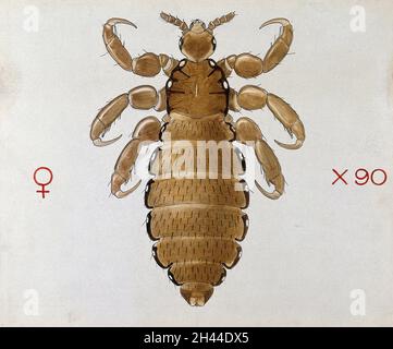Eine Kopflaus (Pediculus humanus). Farbige Zeichnung von A.J.E. Terzi. Stockfoto