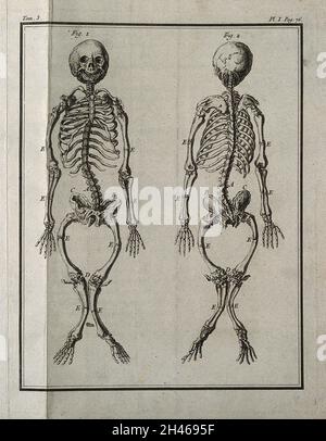 Ein rachitisches Skelett, zwei Fuß zwei Zoll lang, von vorne und hinten gesehen. Gravur, 1749. Stockfoto