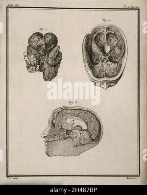 Ein Wachsmodell von Gehirn und Kopf (Abb. 1-2) von F. La Croix nach G. Duverney und ein Wachsmodell eines von Russel hergestellten Hirnabschnitts, 'chirurgien major des Gardes-du-corp' (Abb. 3) Gravur von Moitte nach De Sève, 1749. Stockfoto