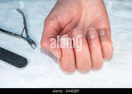 Nahaufnahme einer kaukasischen Frauenhand mit natürlich unpolierten Nägeln, überwucherten Nagelhaut, Pinzette und einer Nagelfeile auf einem textilen weißen Hintergrund. Der Nachteil Stockfoto