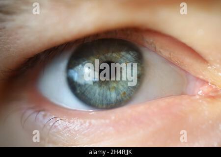 Nahaufnahme des menschlichen Auges, extreme Makroaufnahme des Sehens von Personen, Kapillaren Wimpern und Unvollkommenheiten, verängstigter Blick. Augenheilkunde, Medizin, alternde Chan Stockfoto
