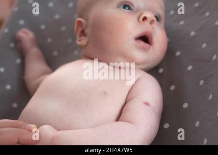 Neugeborene mit Spuren einer BCG-Impfung oder des TB-Impfstoffs am Arm. Stockfoto