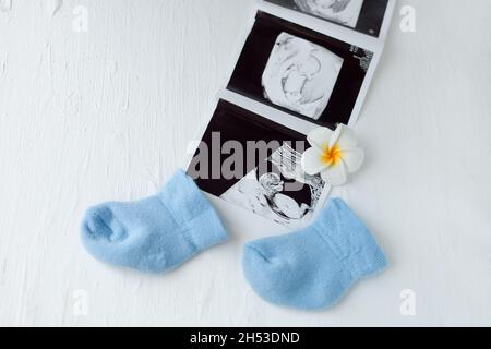 Baby boy blaue Socken mit Ultraschall-Tests Bilder - Schwangerschaftsbetreuung und Mutterschaftskonzept. Gesundheit von Kindern Stockfoto