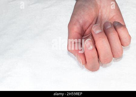 Kaukasische weibliche Hand mit natürlichen unpolierten Nägeln, überwuchert mit Nagelhaut auf einem textilen weißen Hintergrund, Draufsicht, Kopierraum. Das Konzept der Natur Stockfoto