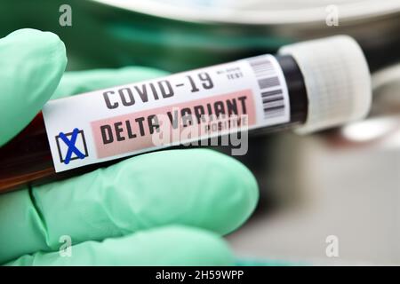 Blutprobe mit Coronavirus Delta-Variante B.1.617.2, Symbolfoto Stockfoto