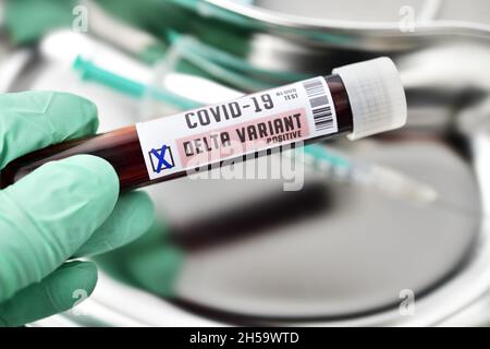 Blutprobe mit Coronavirus Delta-Variante B.1.617.2, Symbolfoto Stockfoto