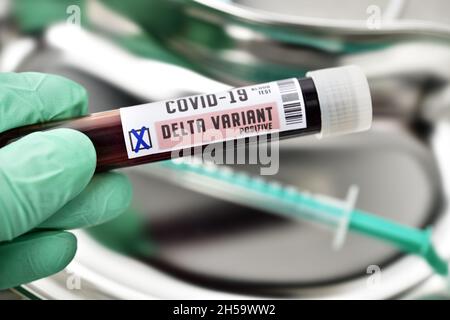 Blutprobe mit Coronavirus Delta-Variante B.1.617.2, Symbolfoto Stockfoto