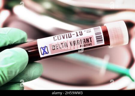 Blutprobe mit Coronavirus Delta-Variante B.1.617.2, Symbolfoto Stockfoto