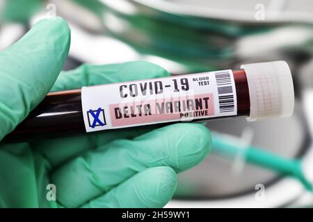 Blutprobe mit Coronavirus Delta-Variante B.1.617.2, Symbolfoto Stockfoto