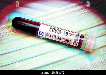 Blutprobe mit Coronavirus Delta-Variante B.1.617.2, Symbolfoto Stockfoto