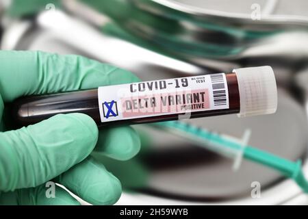 Blutprobe mit Coronavirus Delta-Variante B.1.617.2, Symbolfoto Stockfoto