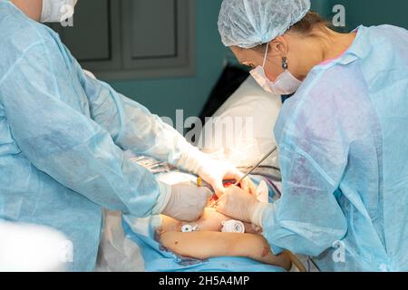 Eine Chirurgin in einer Operationsuniform und einer medizinischen Maske operiert an einem Patienten. Eine Ärztin arbeitet während einer Operation mit medizinischen Instrumenten. Der Chirurg führt eine laparoskopische Operation durch Stockfoto