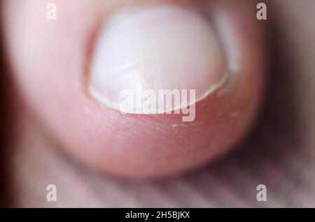 Der Nagel auf dem großen Zeh des Fußes einer Frau. Schöne gepflegte Nägel. Stockfoto