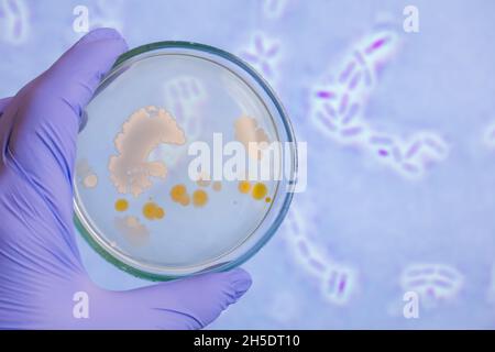 Analyse von Bakterienkolonien auf einer Petrischale gegen Bakterien. Der Wissenschaftler in der Hand hält eine Petrischale vor dem Hintergrund von Bakterien. Stockfoto
