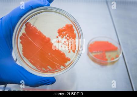 Ein Wissenschaftler mit einer blauen Hand hält eine Petrischale mit Orangenhefe-Kolonien. Laborkultur von Bakterien für Experimente mit Lebensmitteln. Stockfoto