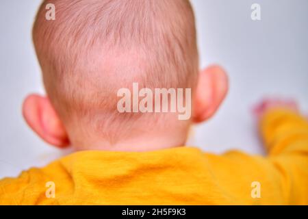 Kahler Fleck auf der Rückseite des Säuglingskopfs. Gerieben Haare des Kleinkindes Stockfoto