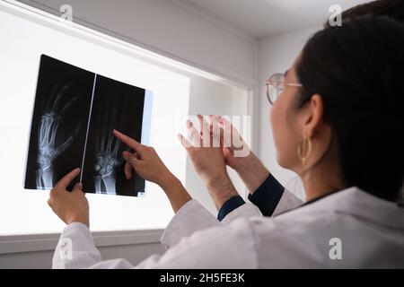 Zwei Ärzte untersuchen das Röntgenbild der Hand. Rheumatoide Arthritis. Stockfoto