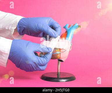 Arzthände kleben einen medizinischen Putz auf ein Modell eines menschlichen Herzens auf einem rosa Hintergrund. Behandlungskonzept für das menschliche Herz-Kreislauf-System, Herzenrektur Stockfoto