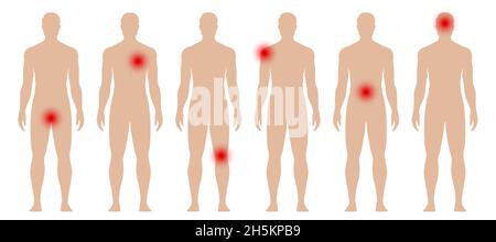 Mann Silhouette mit roten Punkten in verschiedenen Körperteilen. Medizinische Vektordarstellung: Schmerzen und Schmerzen. Stock Vektor