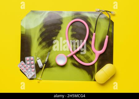 Röntgenaufnahme der Lunge mit Stethoskop und Medikamenten auf farbigem Hintergrund Stockfoto