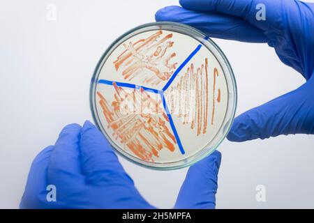 Eine Petrischale mit orangen Bakterienkolonien, die Bakterienkolonien werden in Zonen unterteilt, ein Wissenschaftler hält eine Petrischale auf weißem Hintergrund, Stockfoto