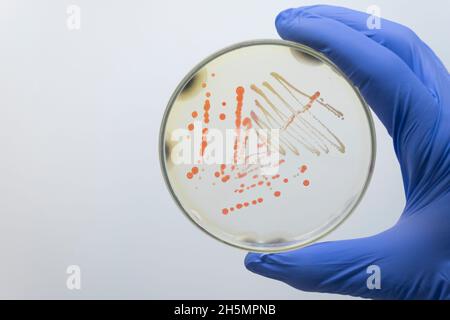 Der Wissenschaftler hält eine Petrischale mit pathogenen Kolonien von orangen und gelben Bakterien mit seiner Handschuhen in der Hand. Isolierung von Bakterien vom Menschen. Stockfoto