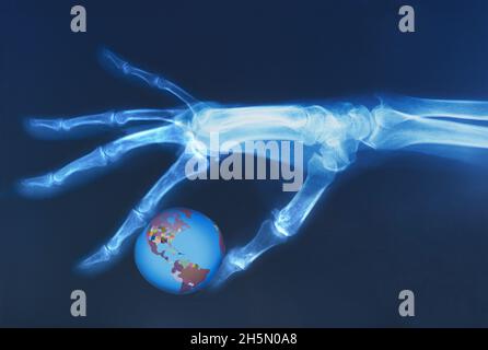 Röntgenbild eines menschlichen Skeletts, das die Weltkugel hält. Gesundheitswesen. Der Mensch zerstört den Planeten. Das medizinische Röntgenbild. Globale Zerstörung, Krieg, Erderwärmung, Klimakrise Stockfoto