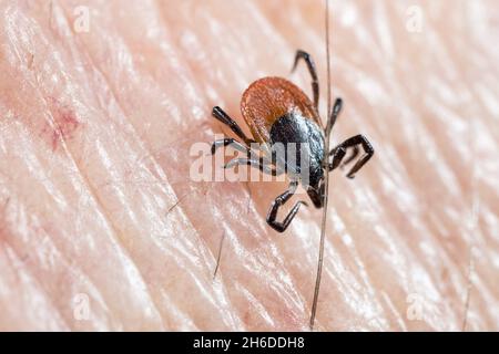 Europäische Rizinusbohne, Europäische Schafszecke (Ixodes ricinus), sitzt auf der menschlichen Haut, Deutschland Stockfoto