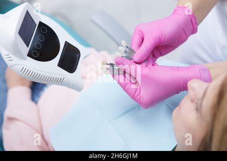 Nahaufnahme eines ausgeschnittenen Zahnarztes mit Beispielen für die Zahnaufhellung des Patienten Stockfoto
