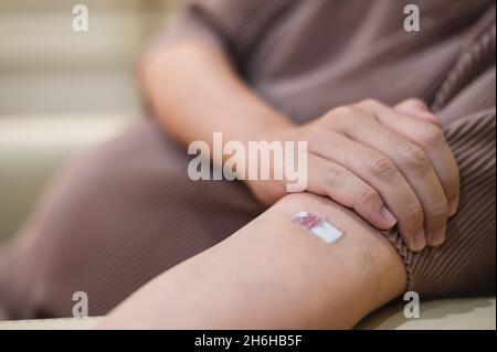 Eine Schwangerin zieht Blut aus einer Injektionswunde am Arm des Patienten. Stockfoto