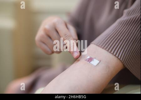 Eine Schwangerin zieht Blut aus einer Injektionswunde am Arm des Patienten. Stockfoto