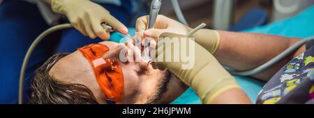 BANNER, LANGFORMAT Mann mit Zähnen bei Zahnärzten untersucht. Zahnärztliche Behandlung in der Zahnmedizin. Termin beim Zahnarzt. Lifestyle, echtes Leben Stockfoto