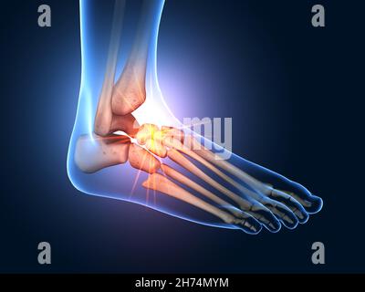 3D Abbildung mit schmerzhaften Fußgelenken Stockfoto