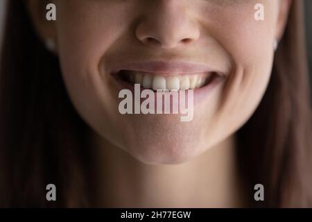 Glückliche junge Frau, die ein perfektes Lächeln mit weißen, geraden Zähnen zeigt. Stockfoto