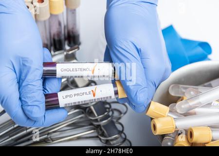 Blutprobe für Cholesterin-Tests. Medizintechnik Stockfoto