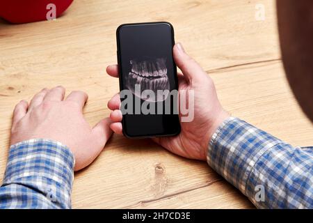 Mann, der ein Röntgenbild seines Kiefers mit einem Zahnimplantat betrachtet. Zahnklinik und kieferorthopädische Behandlung Stockfoto