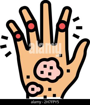 Psoriatic Arthritis Haut Gesundheit Problem Farbe Symbol Vektor Illustration Stock Vektor