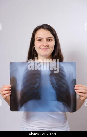 Die Frau hält ein Röntgenbild ihrer Lunge auf Brusthöhe Stockfoto