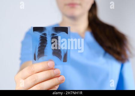 Ein Arzt in blauer Uniform zeigt ein Bild eines Fluorogramms der Fluorographie, eine Röntgenaufnahme der Lunge zur Prävention und Früherkennung Stockfoto