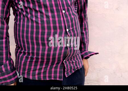 Ein fetter Mann mit engem Hemd, unsicherem Aussehen, hormonelle Disbalance Stockfoto