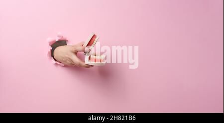 Weibliche Hand hält einen menschlichen Kiefer aus Kunststoff mit weißen, geraden Zähnen auf einem rosa Hintergrund. Ein Teil des Körpers ragt aus einem zerrissenen Loch im Papier, Banner. P Stockfoto