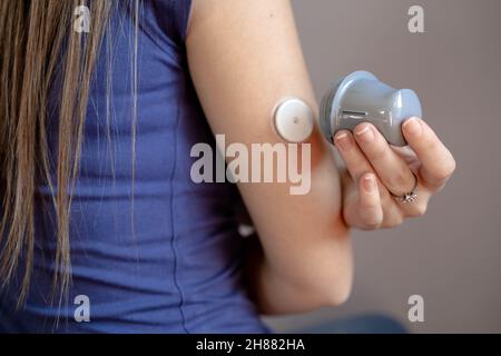 Nahaufnahme eines Mädchens, das einen Blutzuckermessfleck auf ihren Arm aufgesetzt hat Stockfoto